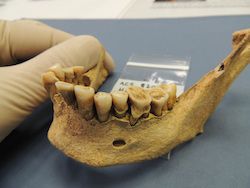 Ученые: у древних людей зубы были здоровее, чем у современных