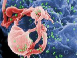 Американские учёные представили вакцину против ВИЧ