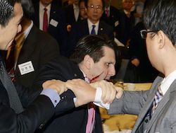 Житель Южной Кореи предложил раненому послу США собачатины
